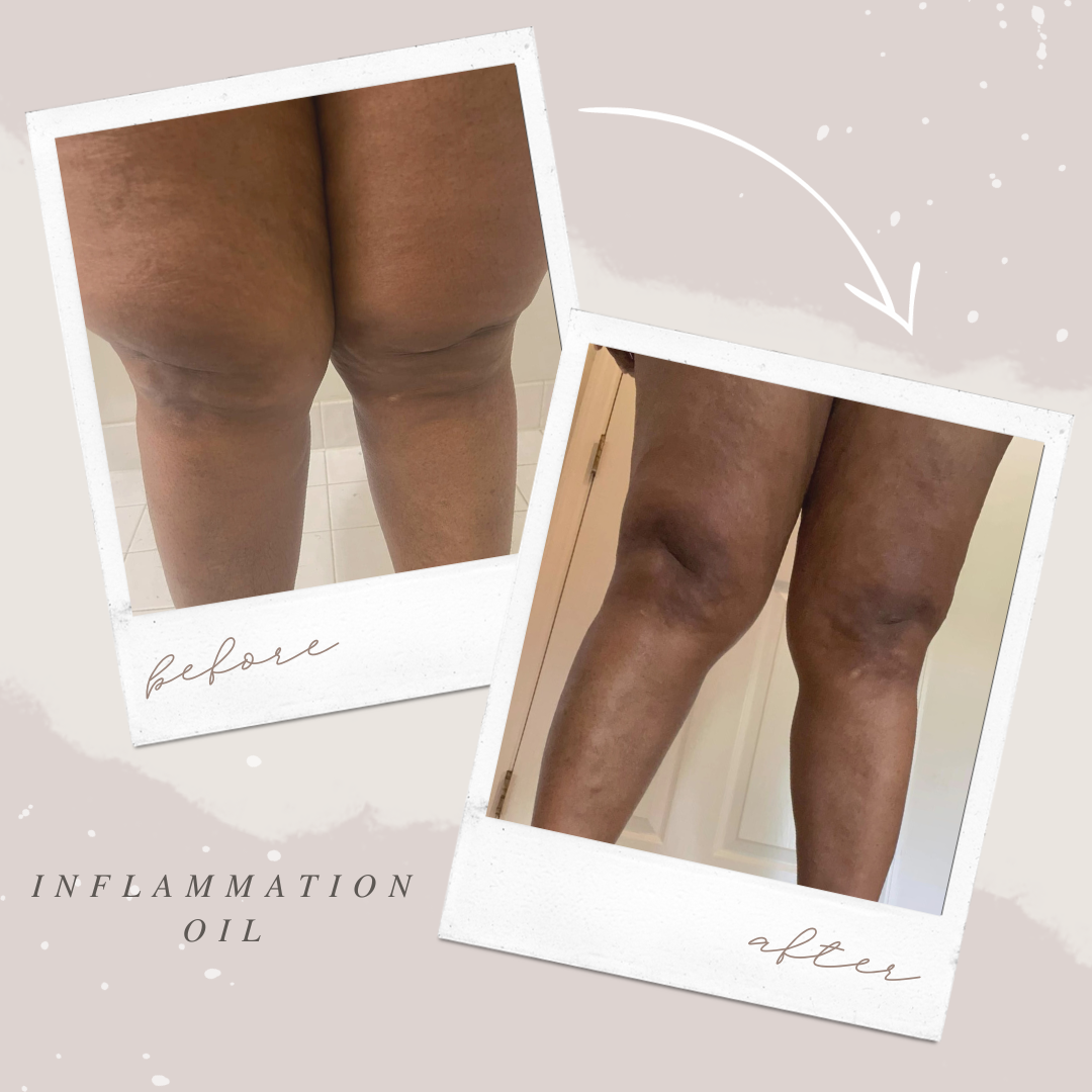 INFLAMMATION OIL
